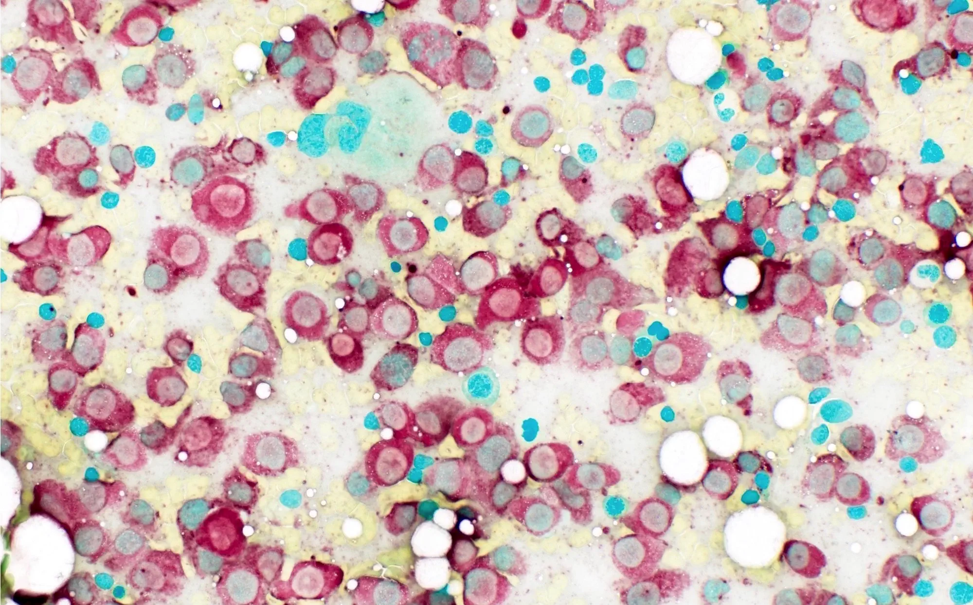 Non-Specific Esterase (NSE) Staining