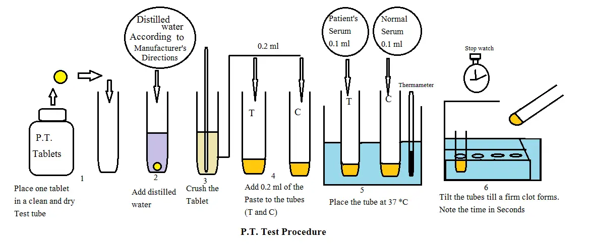 Prothrombin Time