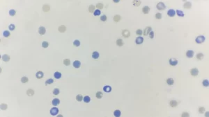 Reticulocyte