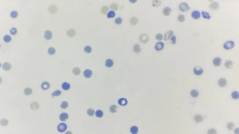 Reticulocyte