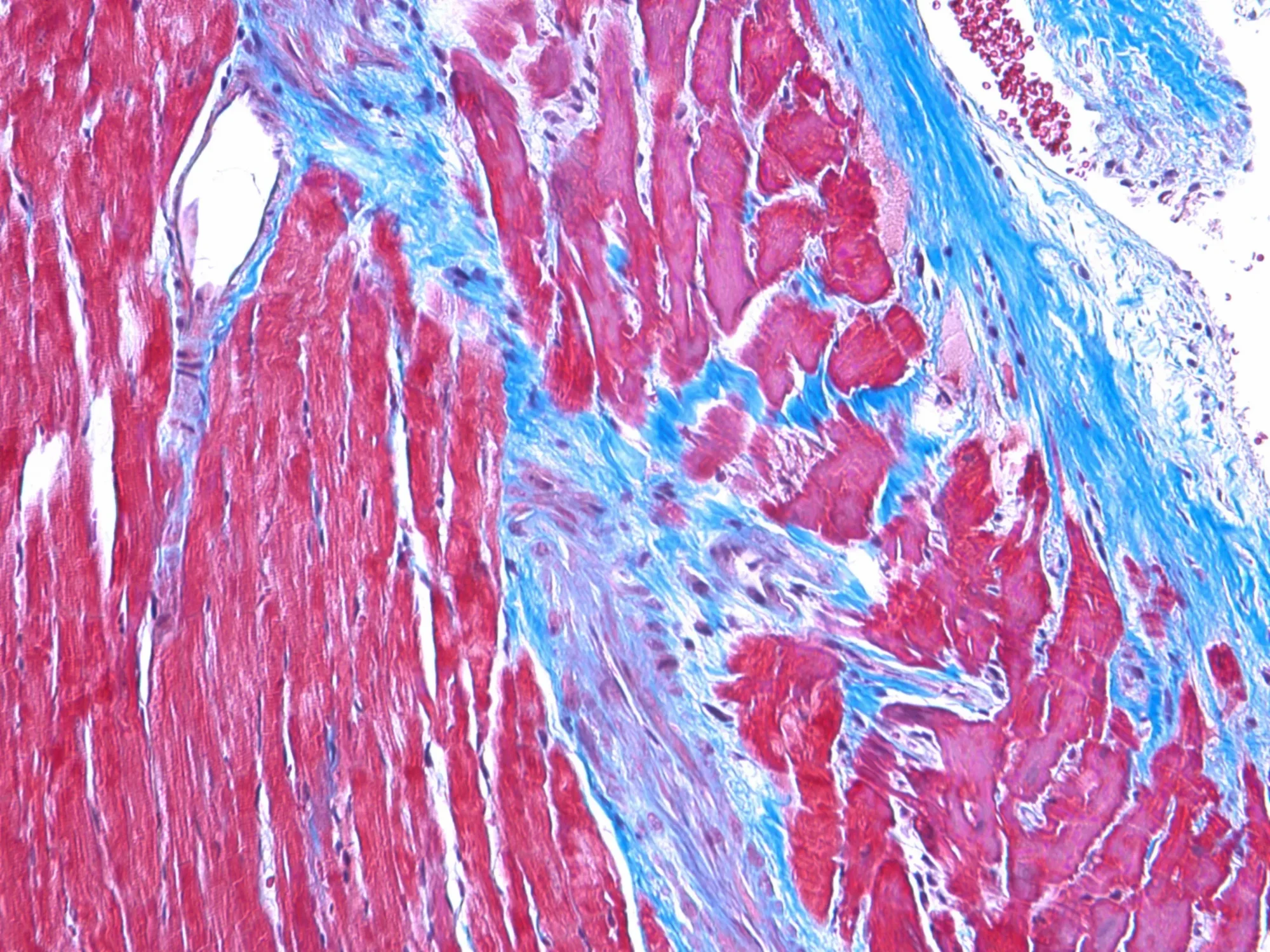 Masson’s Trichrome Stain